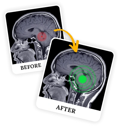 billionaire brain wave results